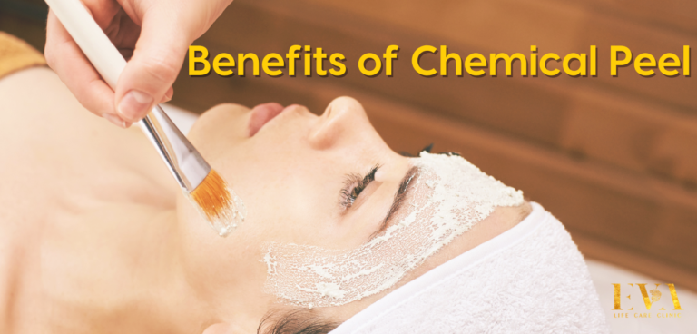 A Complete Guide to Chemical Peels & their Benefits